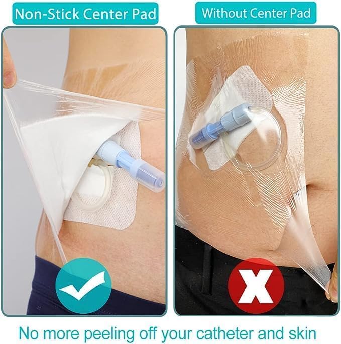 12"x12" Waterproof Shower Cover Incision Bandages for Large Wound with No Glue On The Center Adhesive Transparent Shower Protector Post Surgical Water Barrier Guard Pack of 14